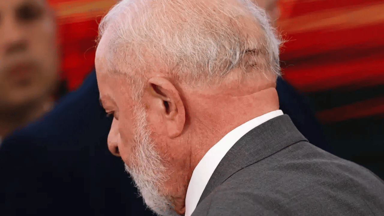 Lula faz cirurgia de emergência após sofrer hemorragia intracraniana